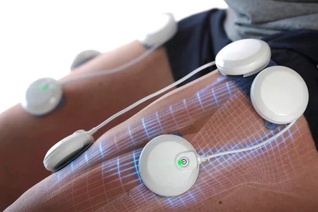 Chattanooga, una marca de Enovis